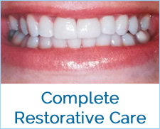 Complete Dental Service