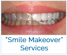 Smile Makeover Services